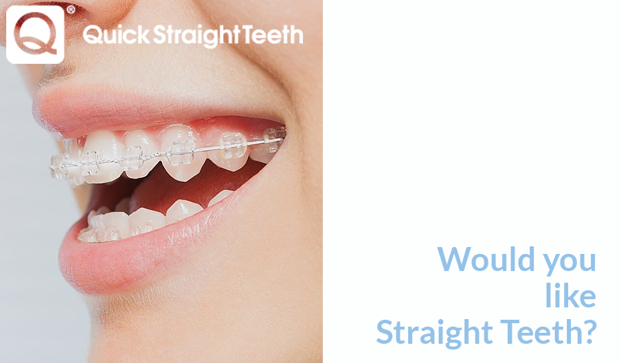 Would you like Straight Teeth?